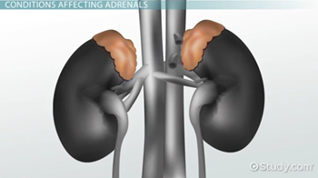 Adrenal Gland Disorders - Lesson | Study.com