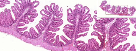 This is a cross-section through the small intestine. The tissue types