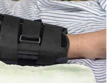 Splint vs. Cast | Overview, Differences & Uses - Lesson | Study.com