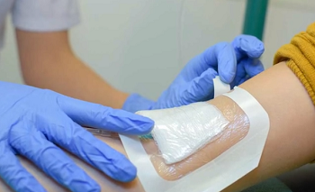 Tunneling vs. Undermining Wound | Definition & Overview - Lesson ...