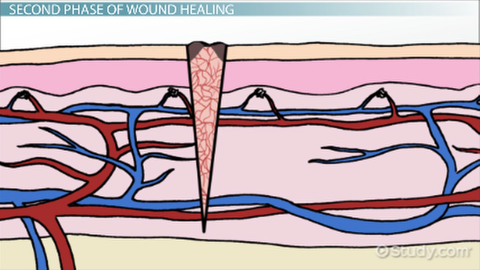 Wound Healing Diagram