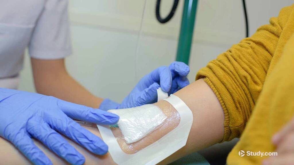 Tunneling vs. Undermining Wound | Definition & Overview - Lesson ...
