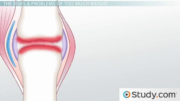 Weight Problems The Issue of Weight Management: Obesity, Risks & Weight Problems ...